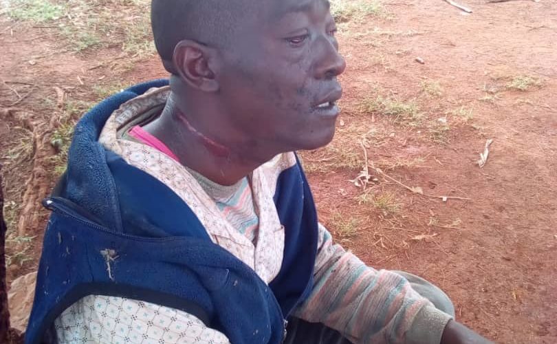 Burundi : Un citoyen burundais échappe à une tentative d’assassinat par étranglement par 6 militaires rwandais